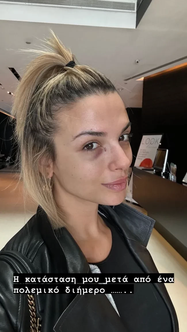katerina-liolioy-injpg-1.webp